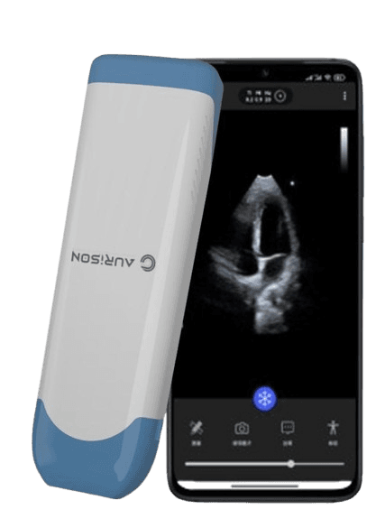 Aurison Device with Mobile App