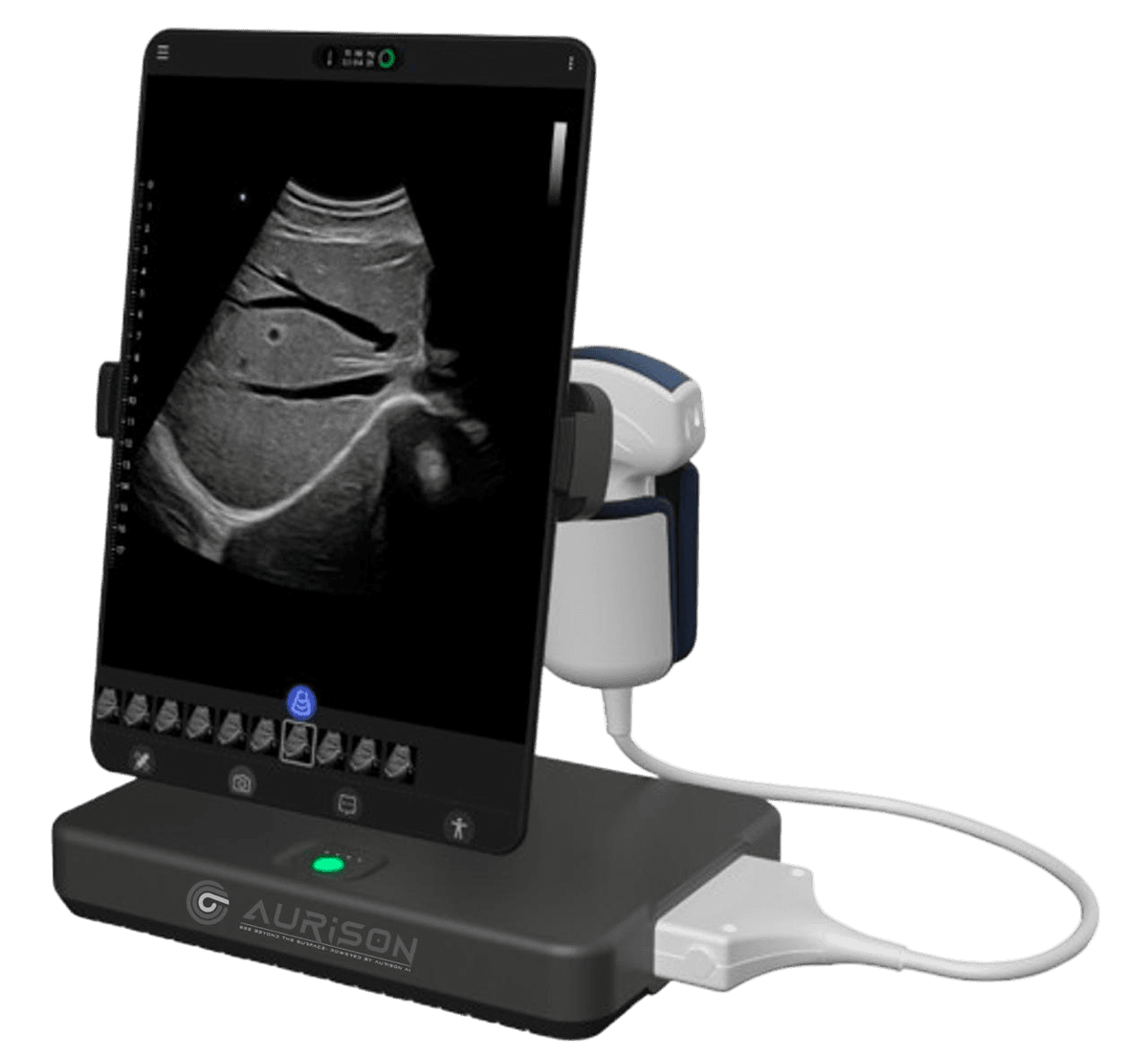 Aurison Ultra ultrasound device